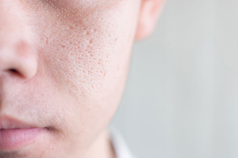 close-up of pores